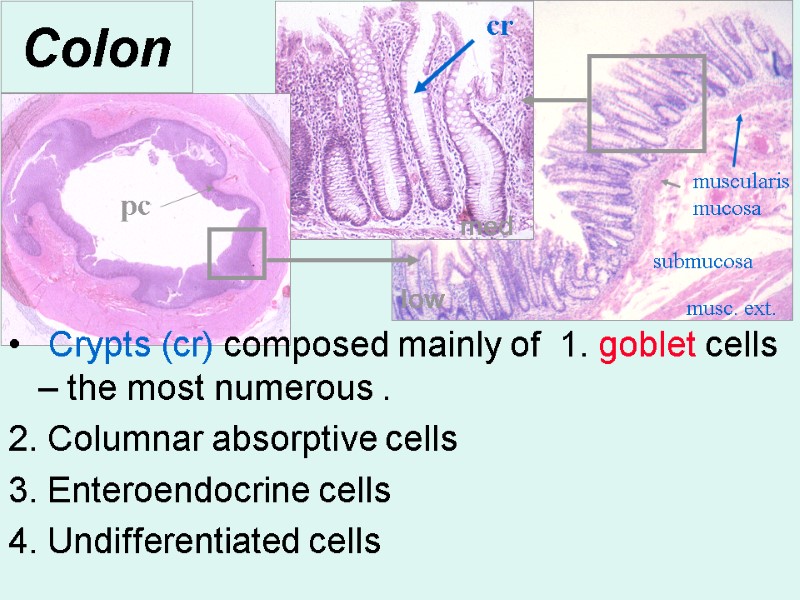 Colon  Crypts (cr) composed mainly of  1. goblet cells – the most